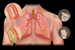 咳止不住、痰咳不出、气喘不顺？通调身体从补肺开始